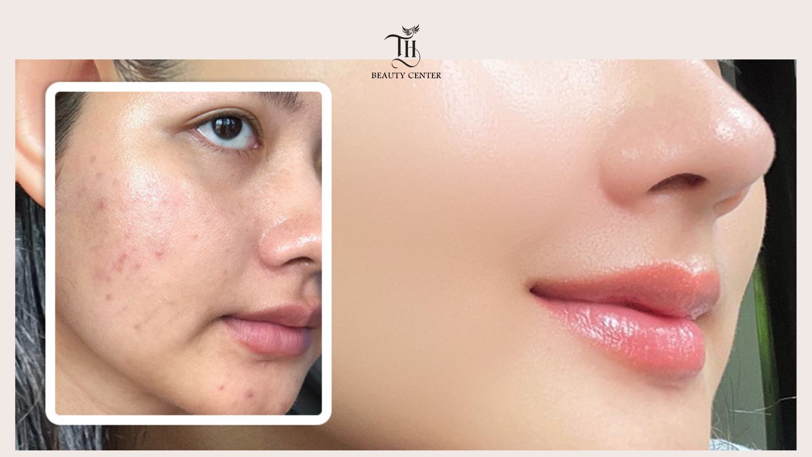 các bước skincare